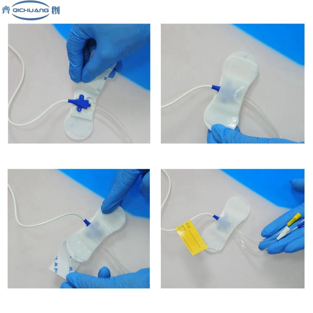 Hot Selling Chinese Manufacturer OEM Wholesale Surgical Tube Body Surface Fixing Picc Catheter Fixation Device