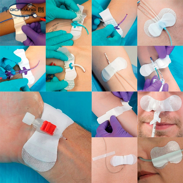 Hot Selling Chinese Manufacturer OEM Wholesale Surgical Tube Body Surface Fixing Picc Catheter Fixation Device